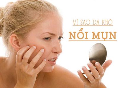 Tiết lộ cách cải thiện tình trạng da khô nổi mụn ở phụ nữ
